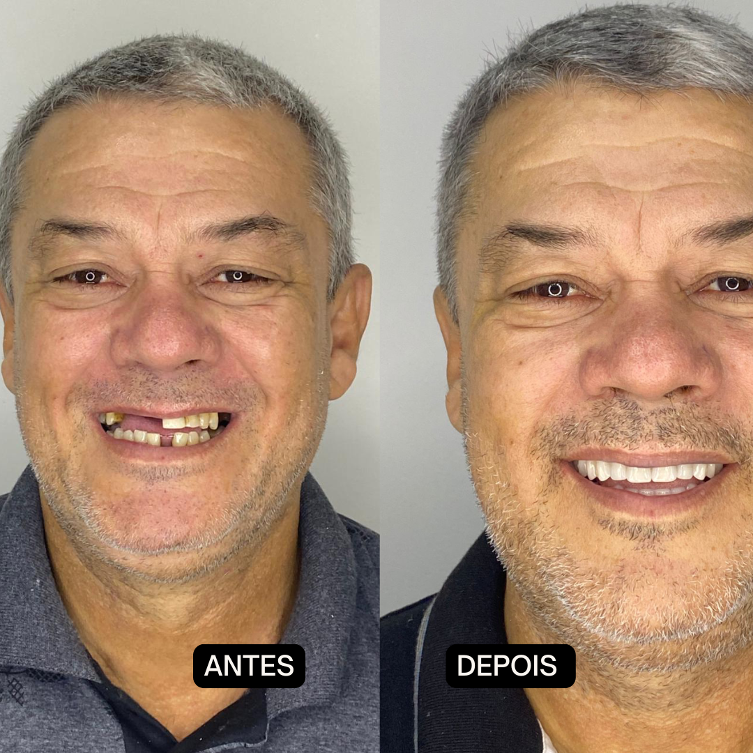 Beige Minimalist Skincare Before and After Instagram Post (1)