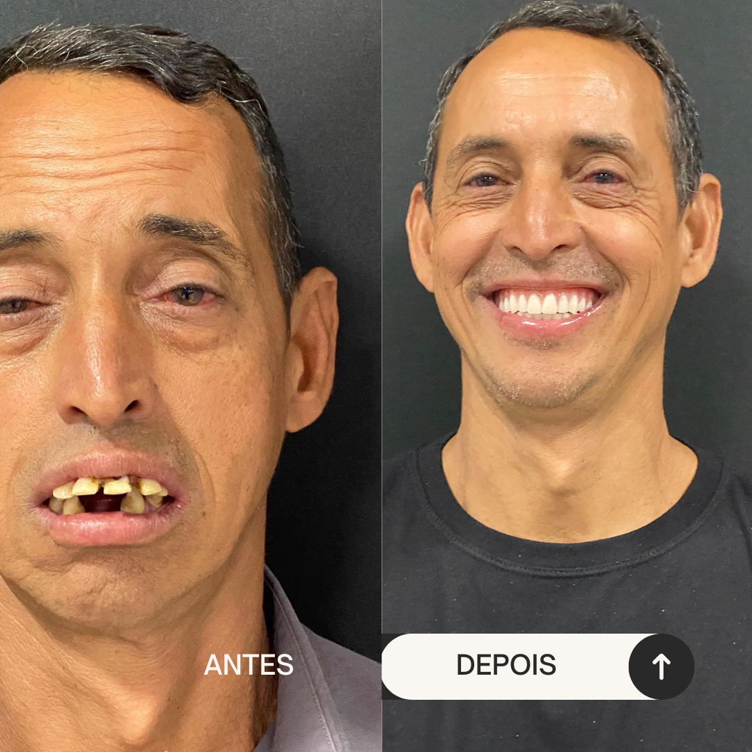 Beige Minimalist Skincare Before and After Instagram Post